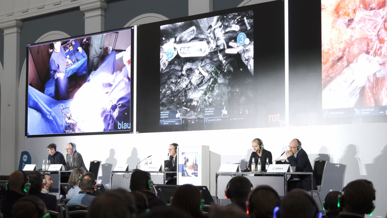 Auf dem 15. Symposium der Deutschen Gesellschaft für Roboter-assistierte Urologie e. V. führten Chirurgen mithilfe von ferngesteuerten Roboter­armen von Hamburg aus Operationen in Peking, Aalst und Madrid durch, die über Bildschirme live in die Handelskammer übertragen wurden.